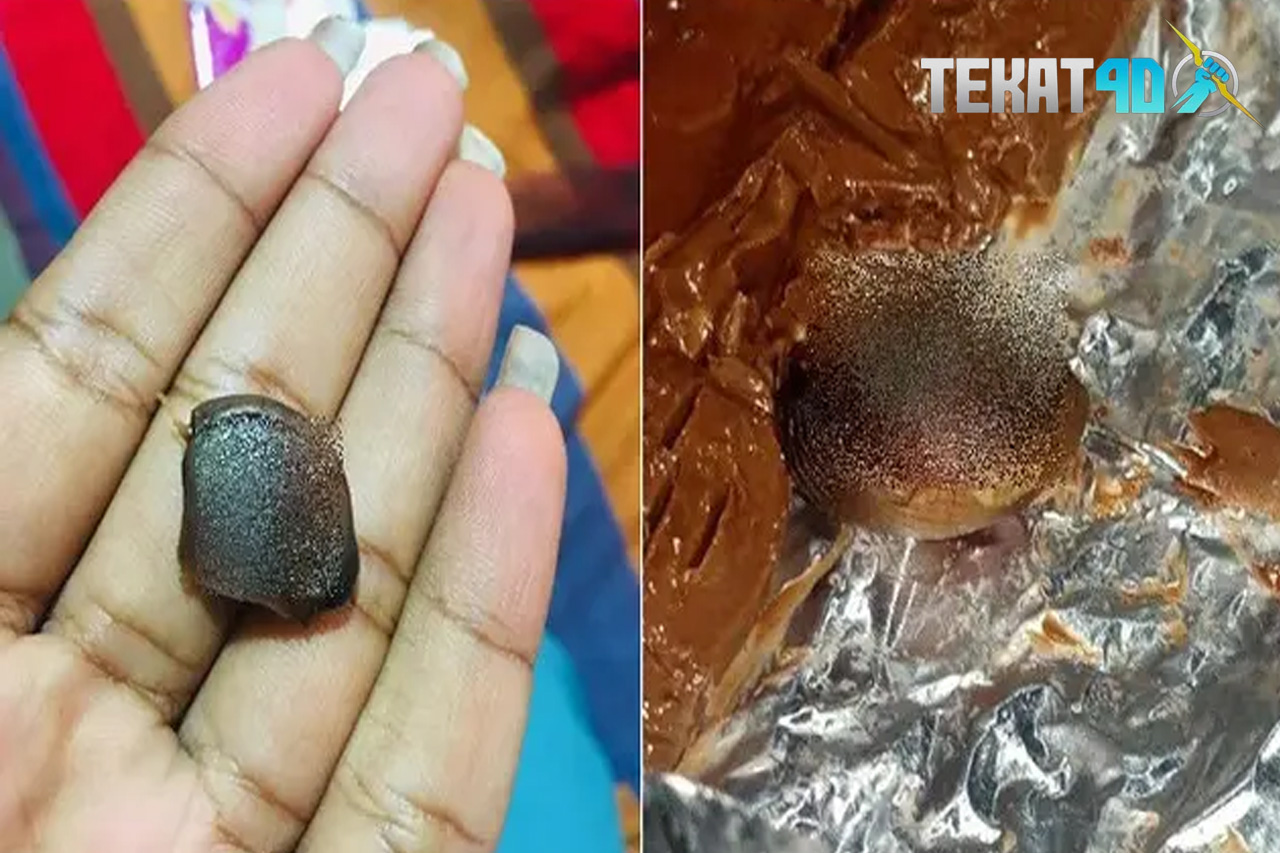 Mirip Asam Jawa, Wanita Ini Temukan Potongan Jari Manusia Dalam Cokelat Batangan