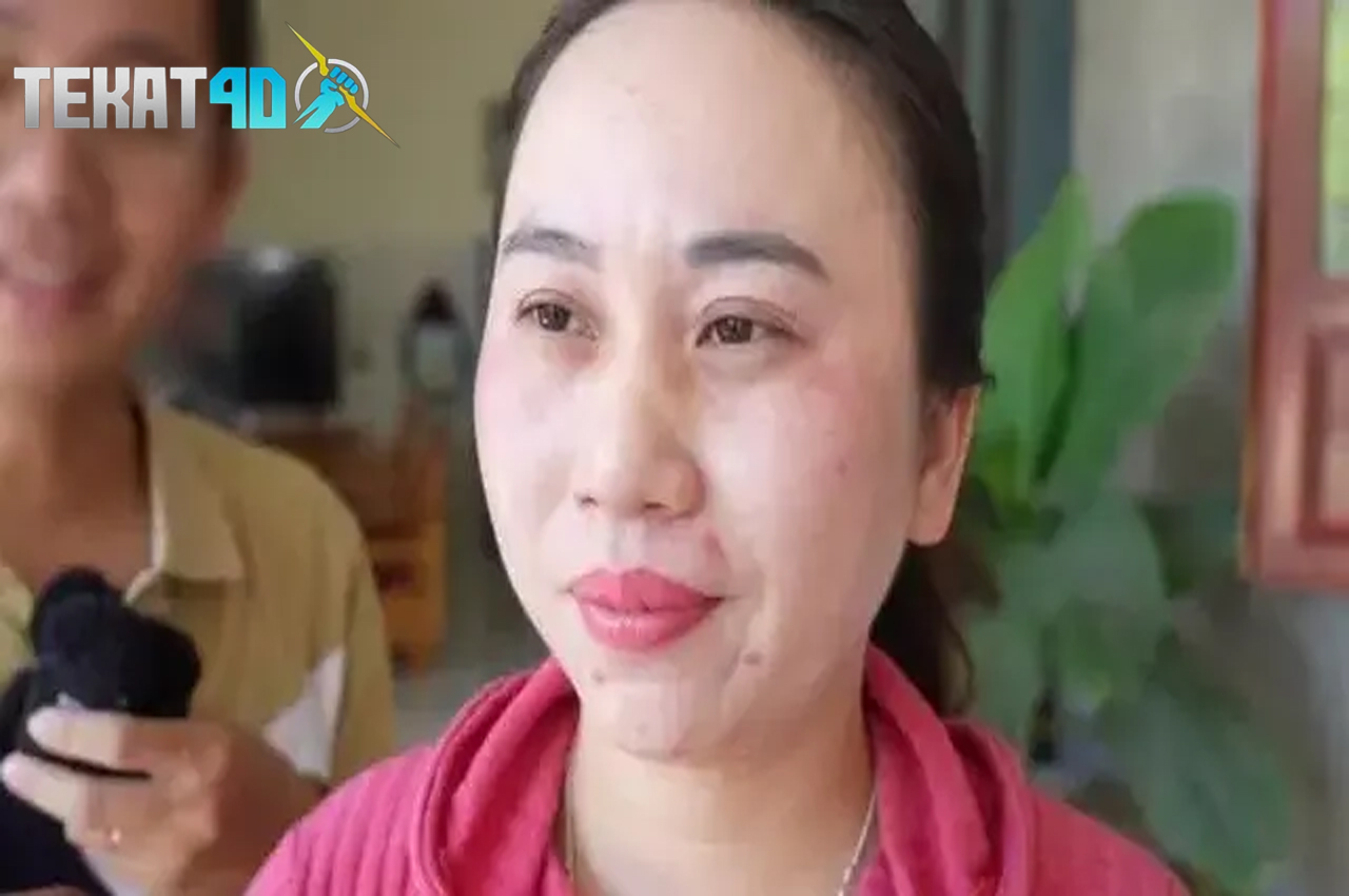 Viral, Wanita Asal Vietnam Ini Akui Belum Tidur Selama 11 Tahun Lebih