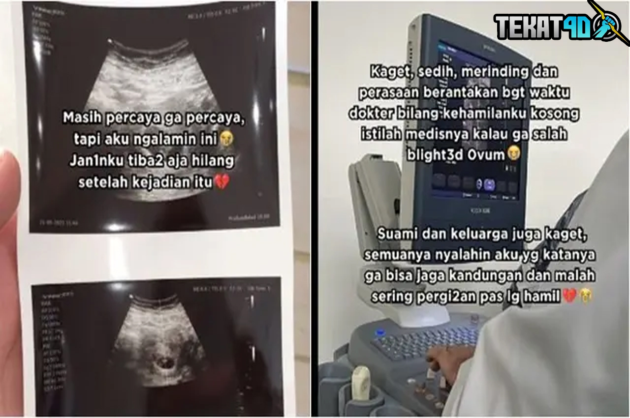 Viral, Ibu Hamil Ini Klaim Janinnya Hilang Usai Bertemu Nenek-Nenek saat Maghrib